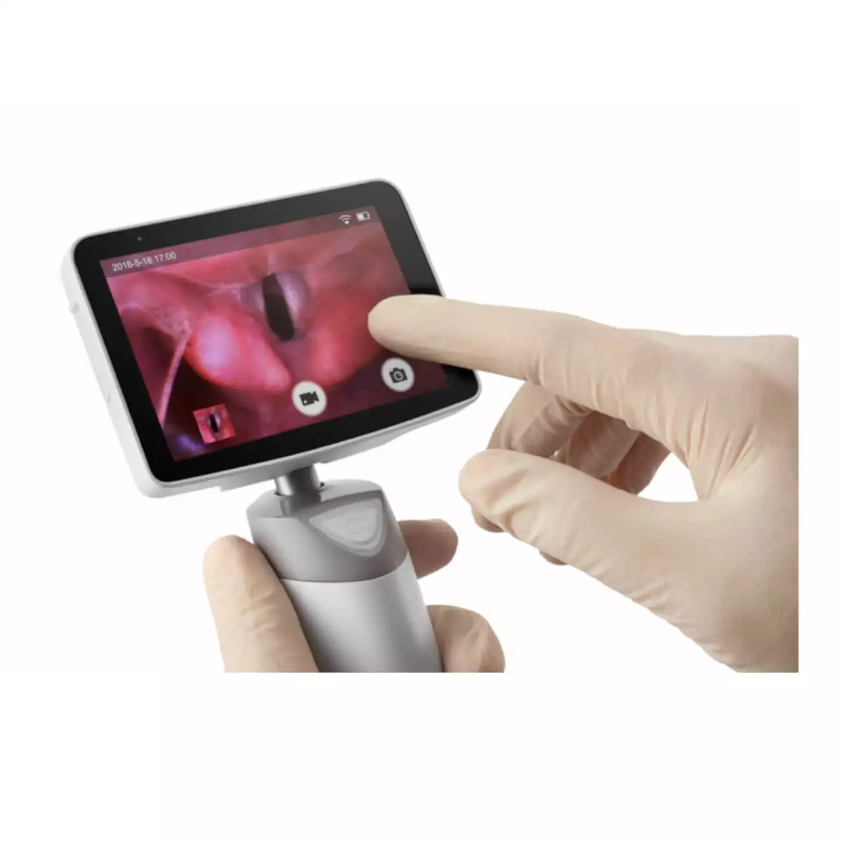  VS-10 Video-Laryngoskop