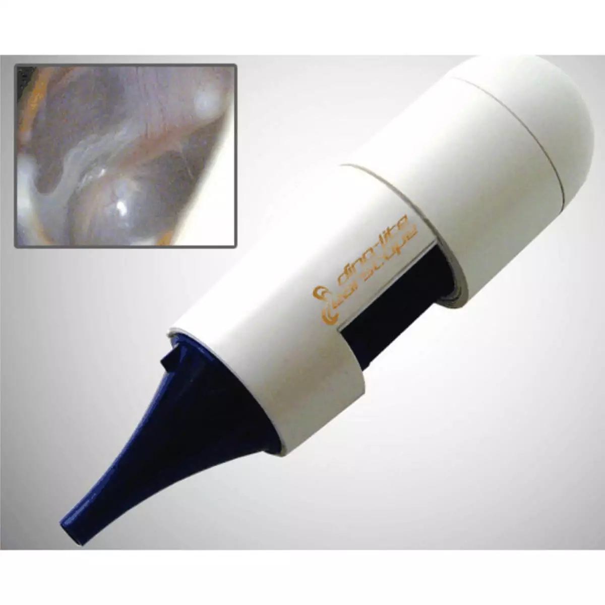  EarScope Pro Wireless Videootoskop
