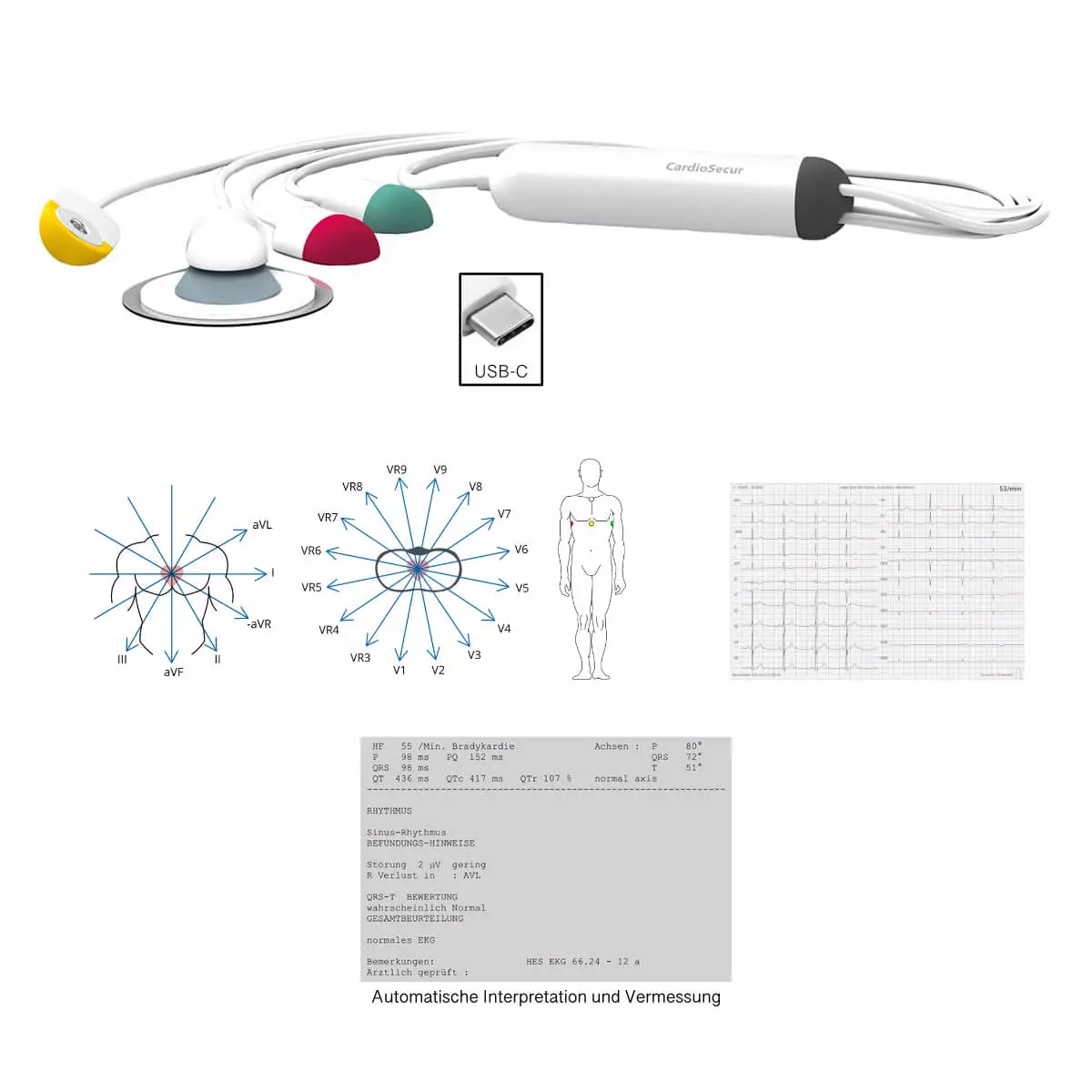  CardioSecur Pro EKG