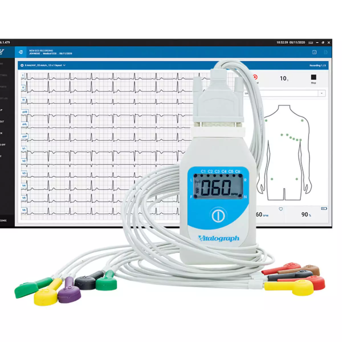 BT12 Ruhe-EKG mit Bluetooth-Konnektivität