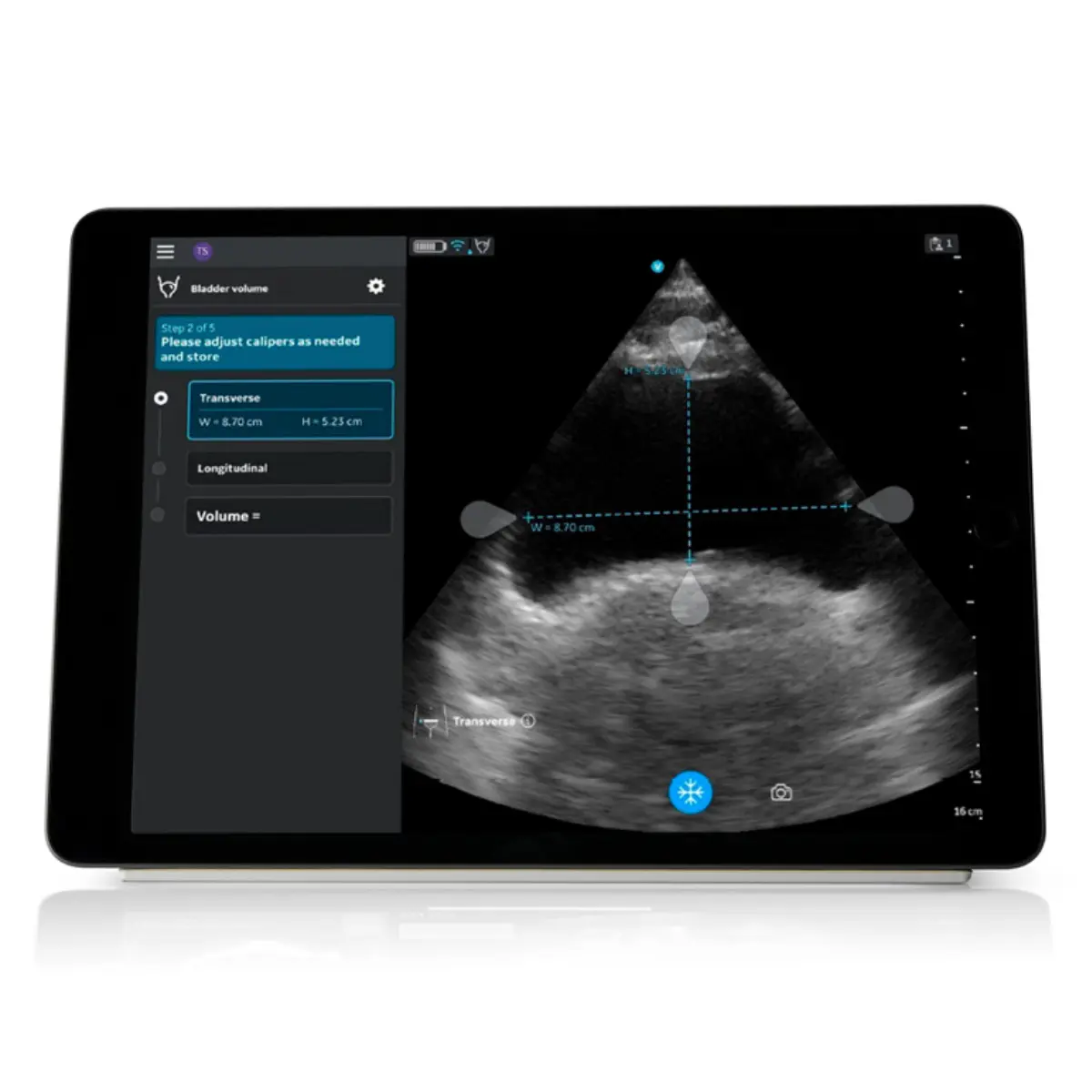 Auto-Bladder-Volume-Upgrade für VScan Air CL Auto-Bladder-Volume-Upgrade für VScan Air CL