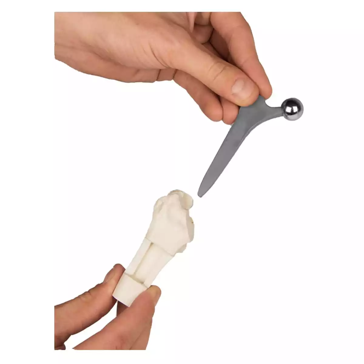  Hüft-Implantat-Modell