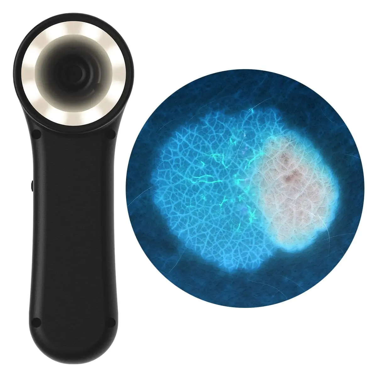  Digitales Dermatoskop "Scaut®"