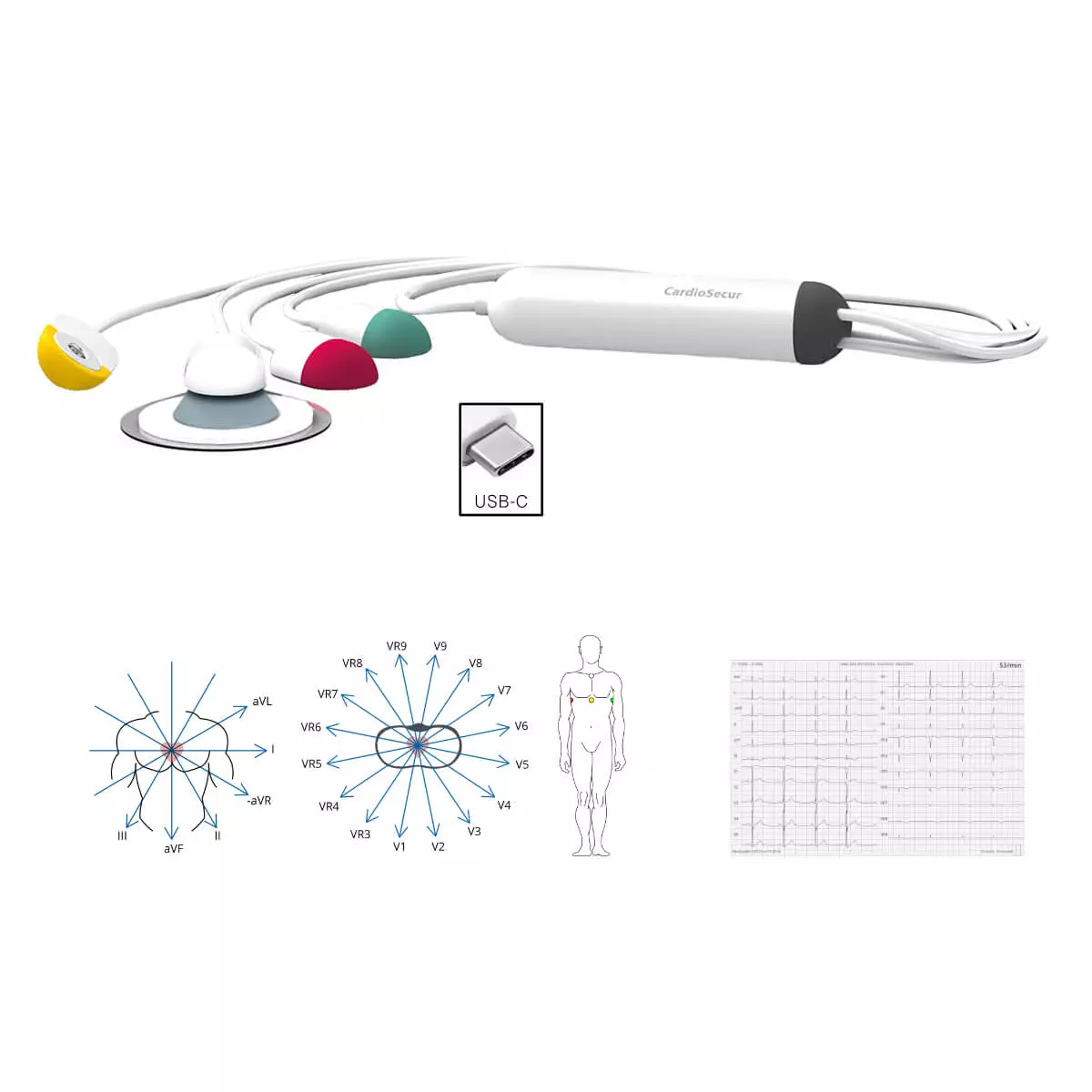 CardioSecur Pro EKG CardioSecur Pro EKG