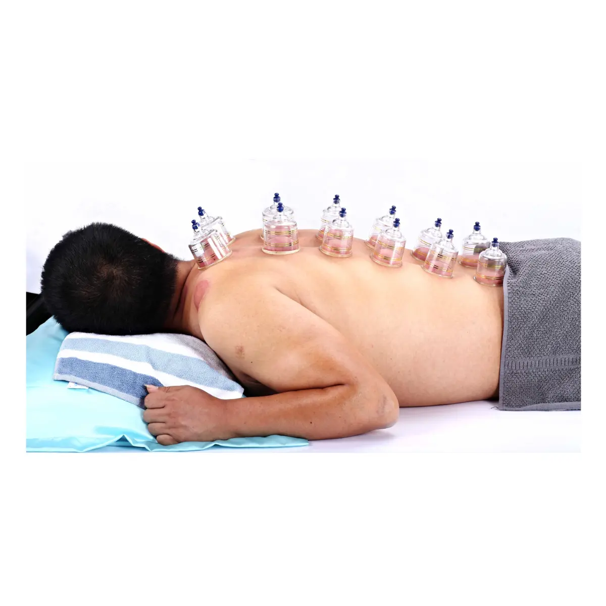 Schröpfkopf-Set mit Vakuum-Handpumpe Schröpfkopf-Set mit Vakuum-Handpumpe