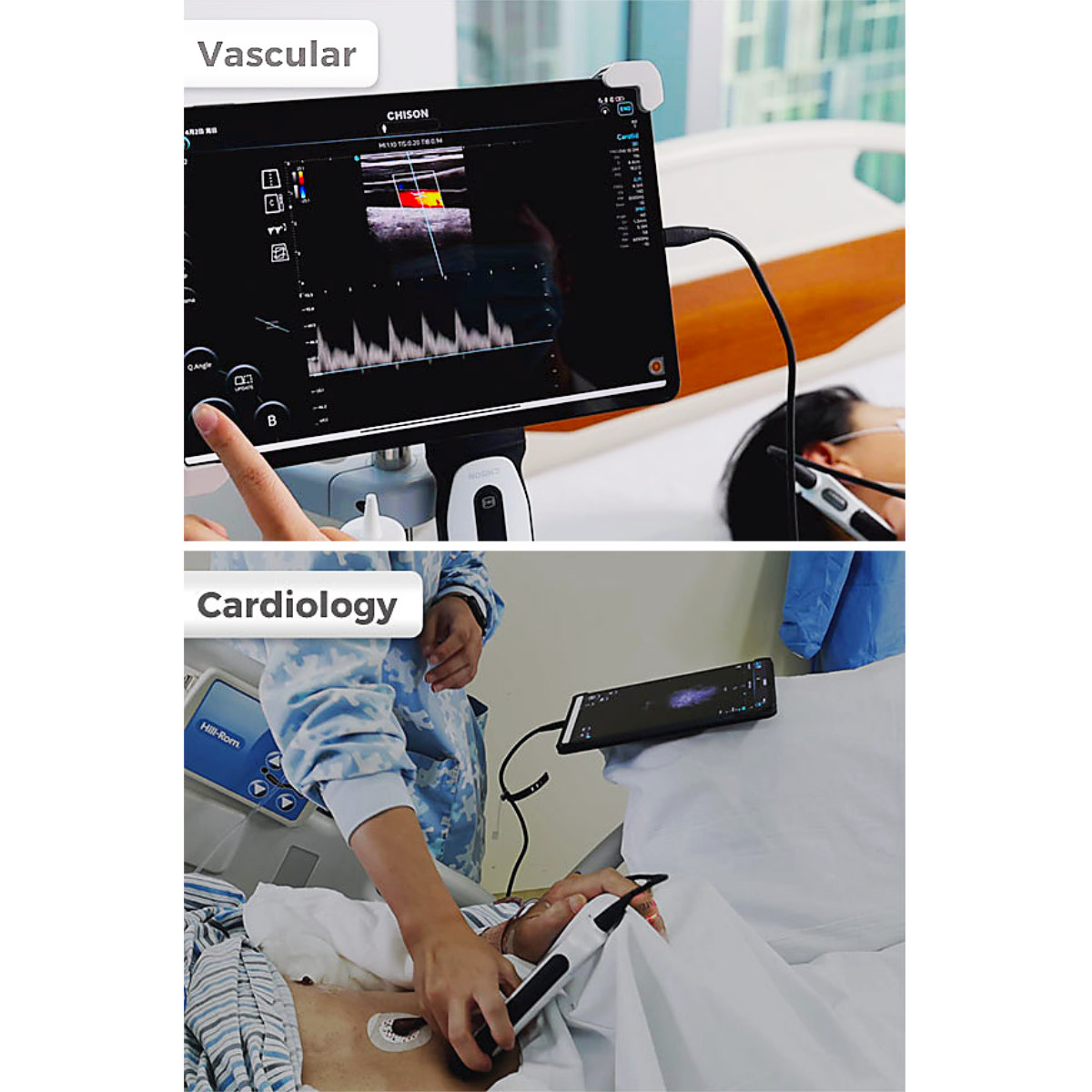  SonoEye mobiles Ultraschallsystem