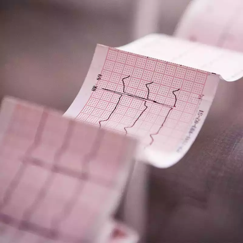Kategorie 800x800 Ekg Messung