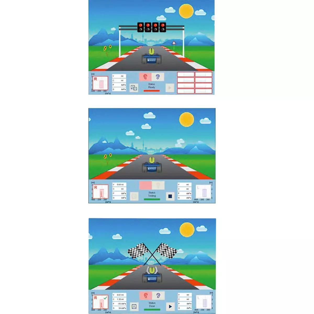  touchTymp RaceCar MI 24 Tympanometer