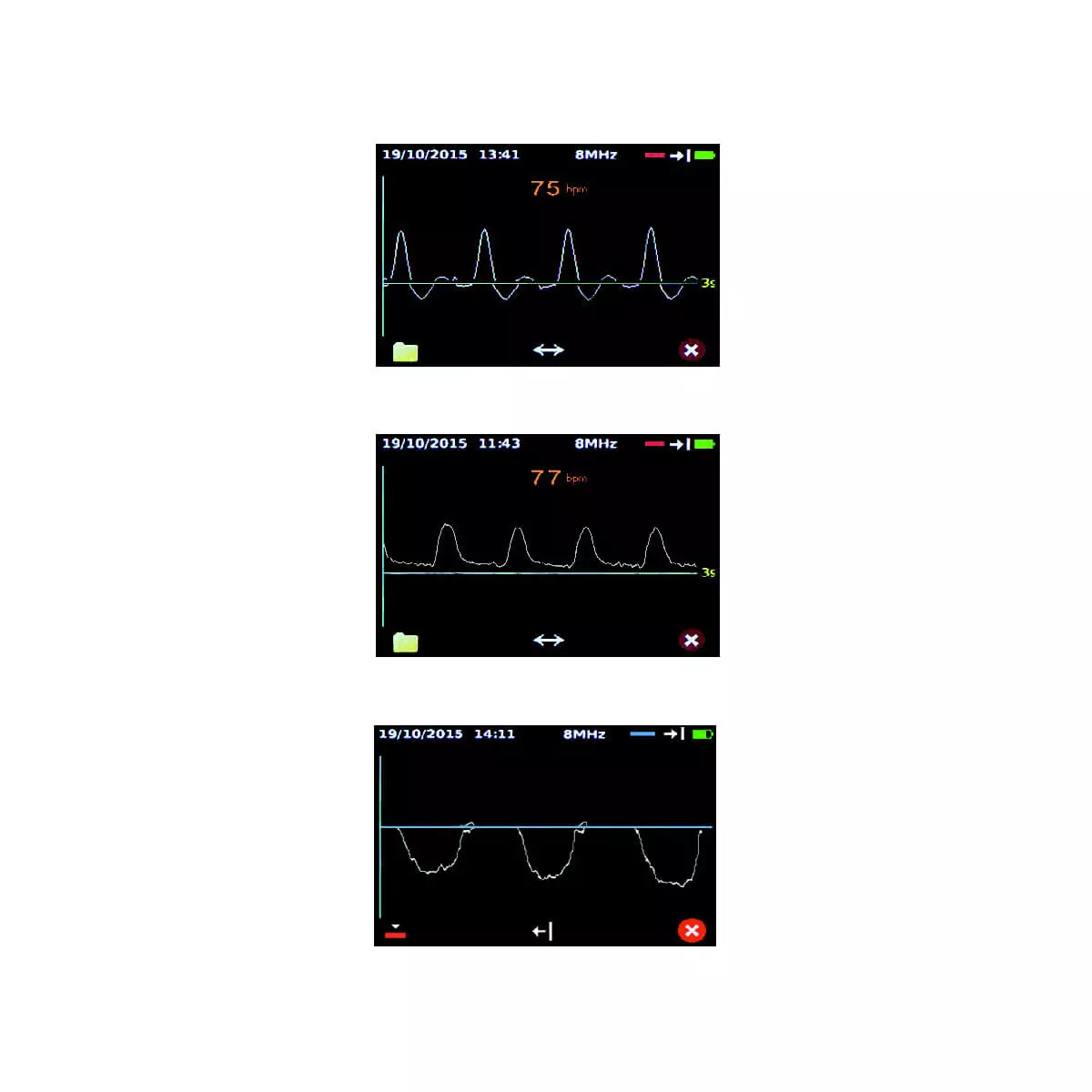  Dopplex DMX Gefäßdoppler