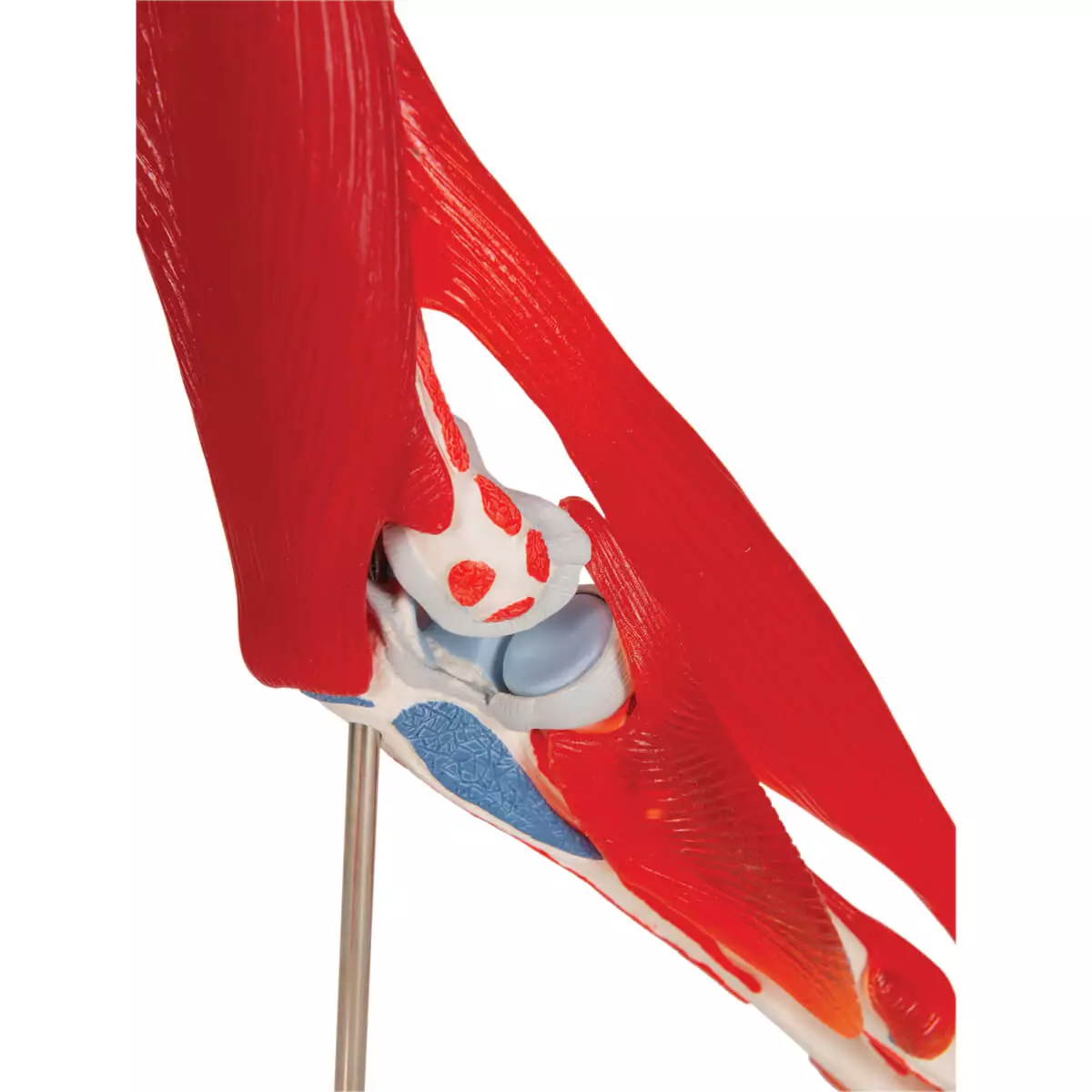  Ellenbogengelenkmodell