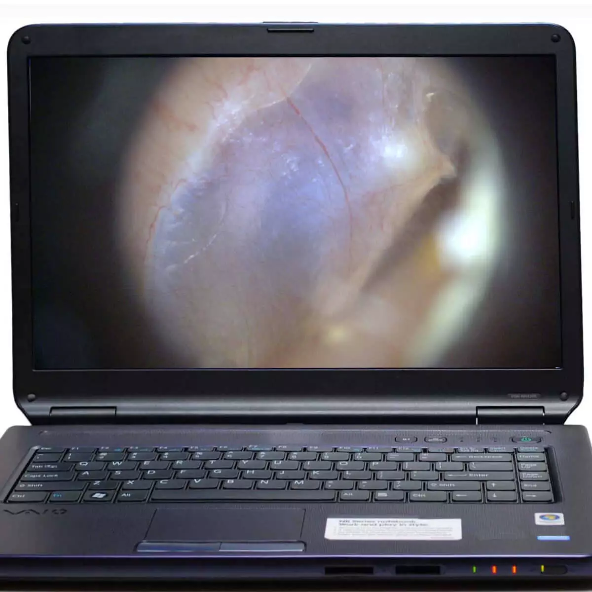  EarScope Pro Wireless Videootoskop