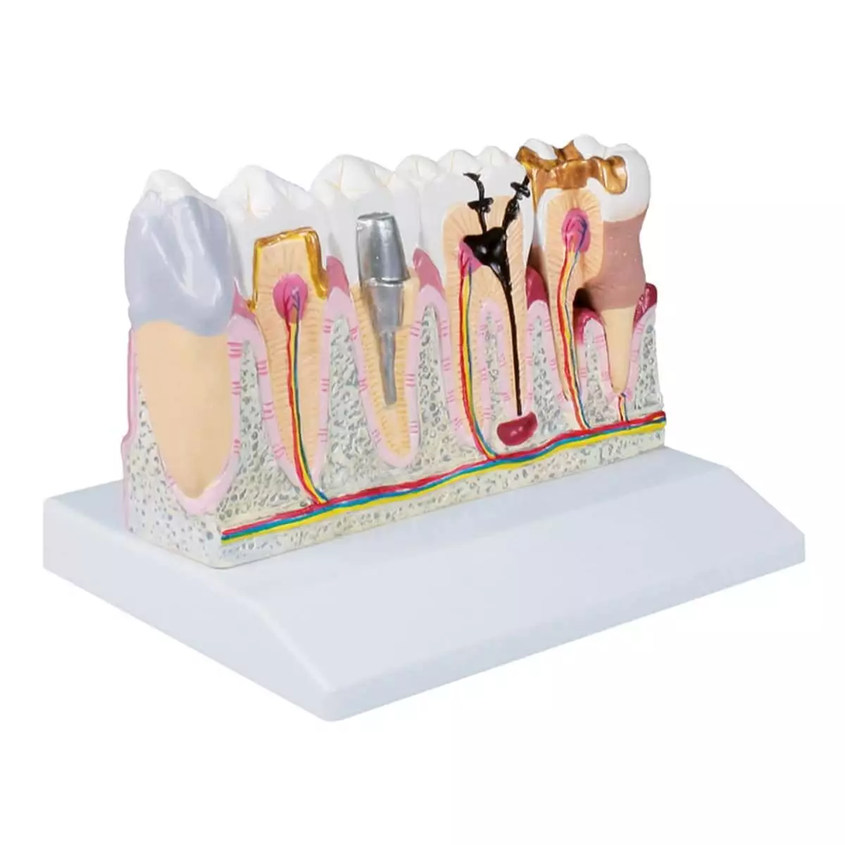  Dentalmodell
