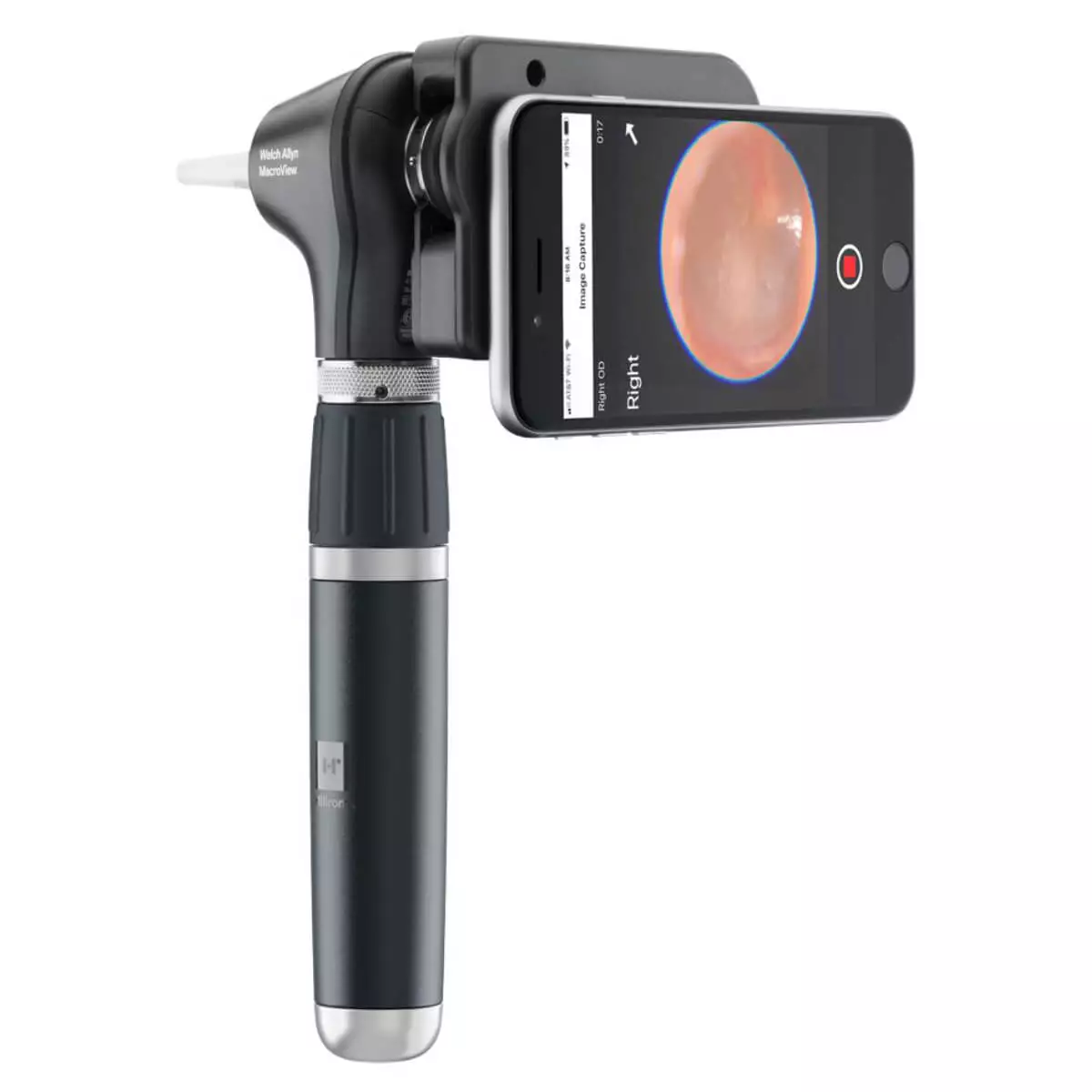  Diagnostik-Set mit MacroView Plus Otoskop & iExaminer-Kit