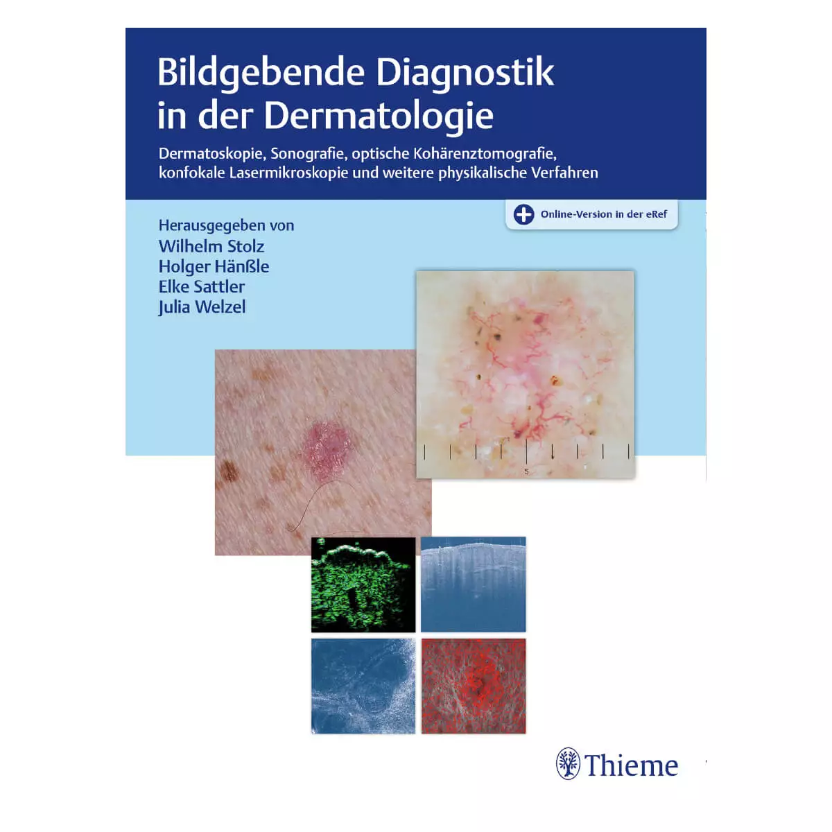  Bildgebende Diagnostik in der Dermatologie