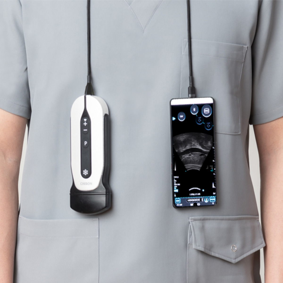  SonoEye mobiles Ultraschallsystem