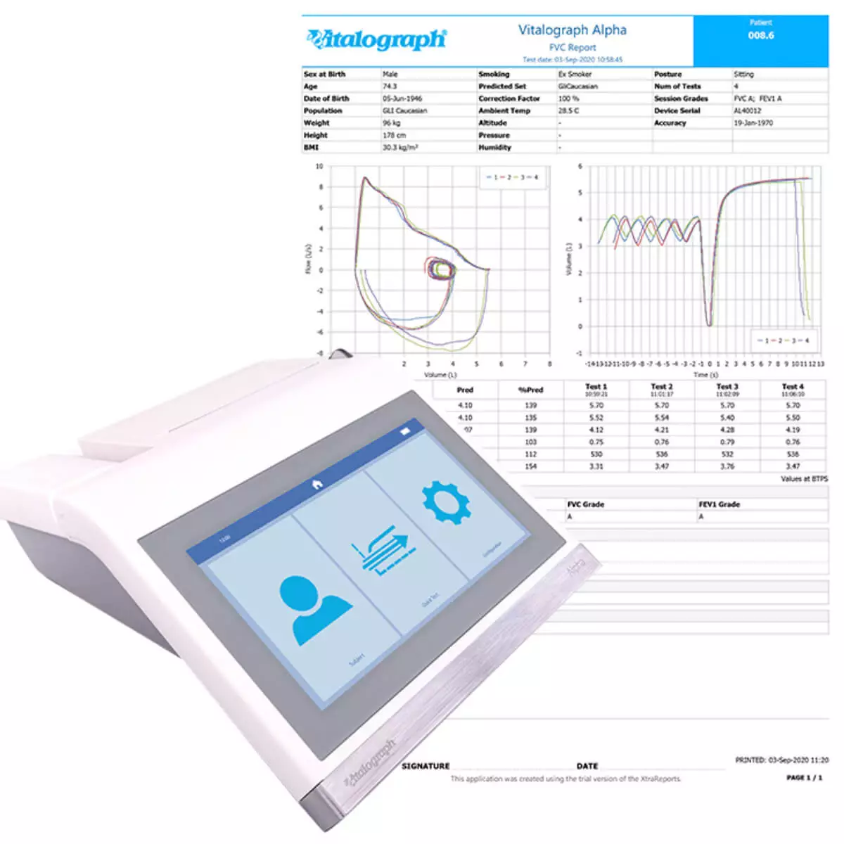  ALPHA Connect All-in-One Spirometer