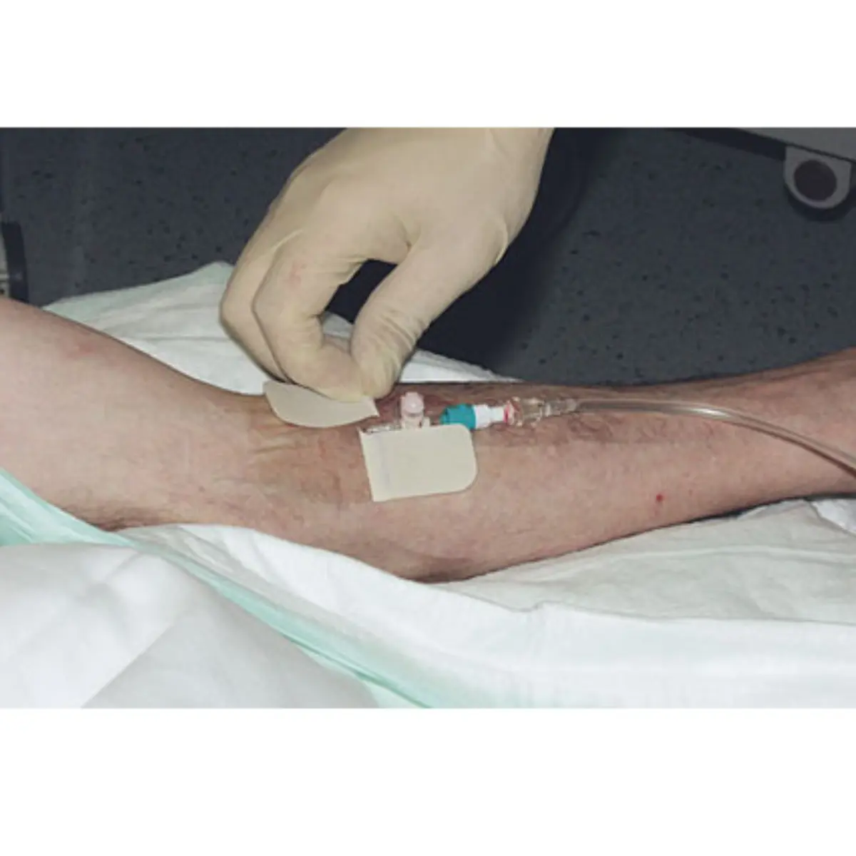  RUDAVEN-transparent Kanülenfixierpflaster