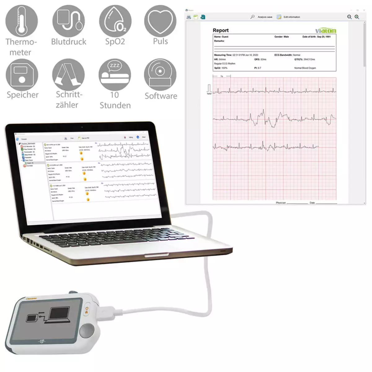 Checkme Pro by Viatom EKG-Monitor Checkme Pro by Viatom EKG-Monitor