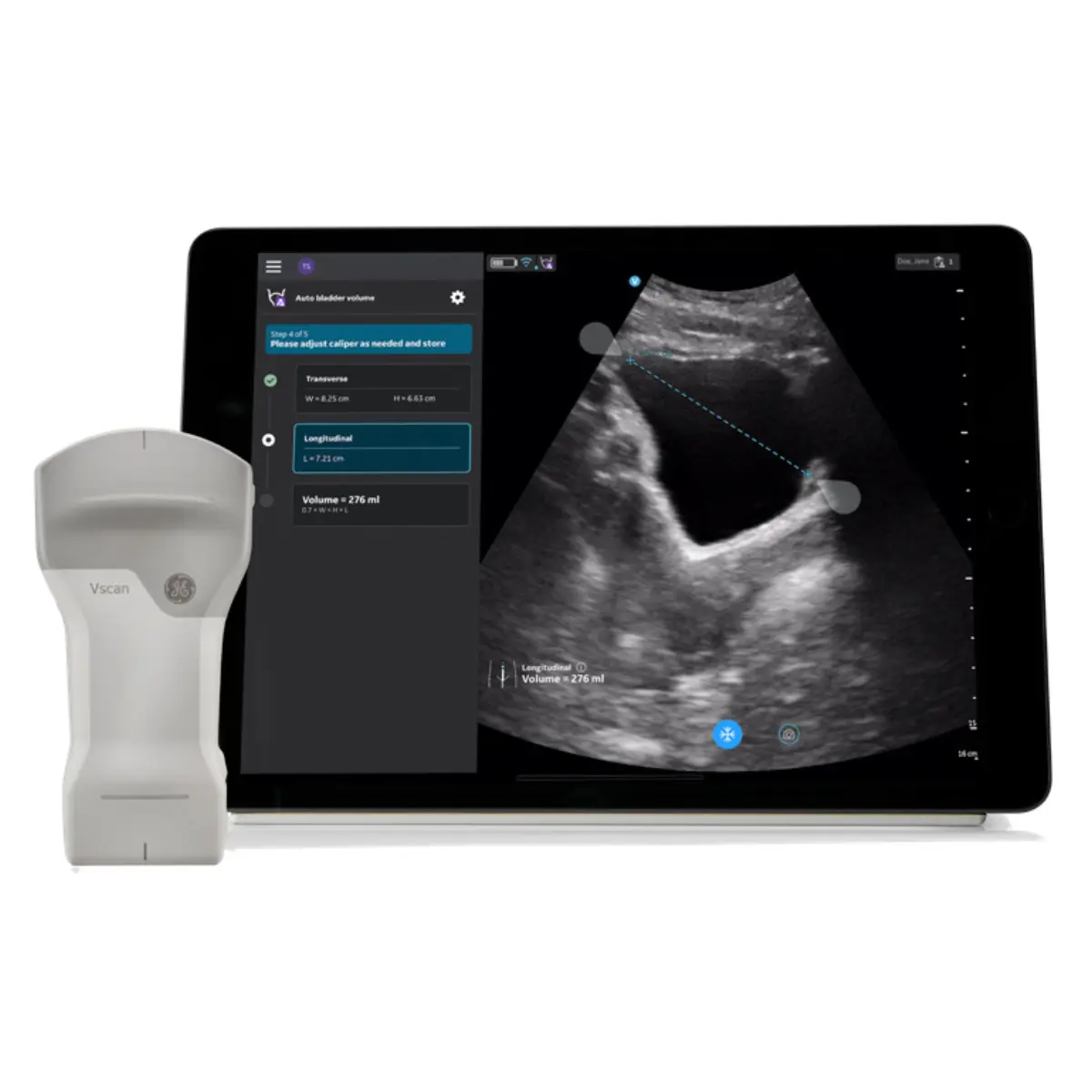 Auto-Bladder-Volume-Upgrade für VScan Air CL Auto-Bladder-Volume-Upgrade für VScan Air CL