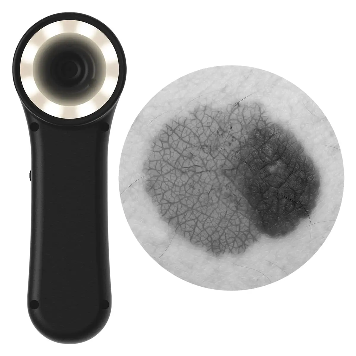  Digitales Dermatoskop "Scaut®"