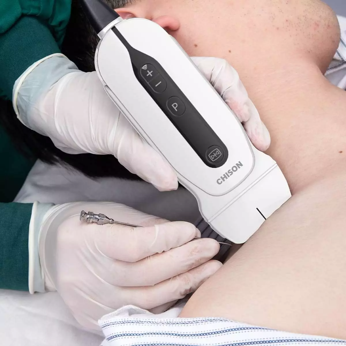 SonoEye G2 Handheld Ultraschallgerät SonoEye G2 Handheld Ultraschallgerät