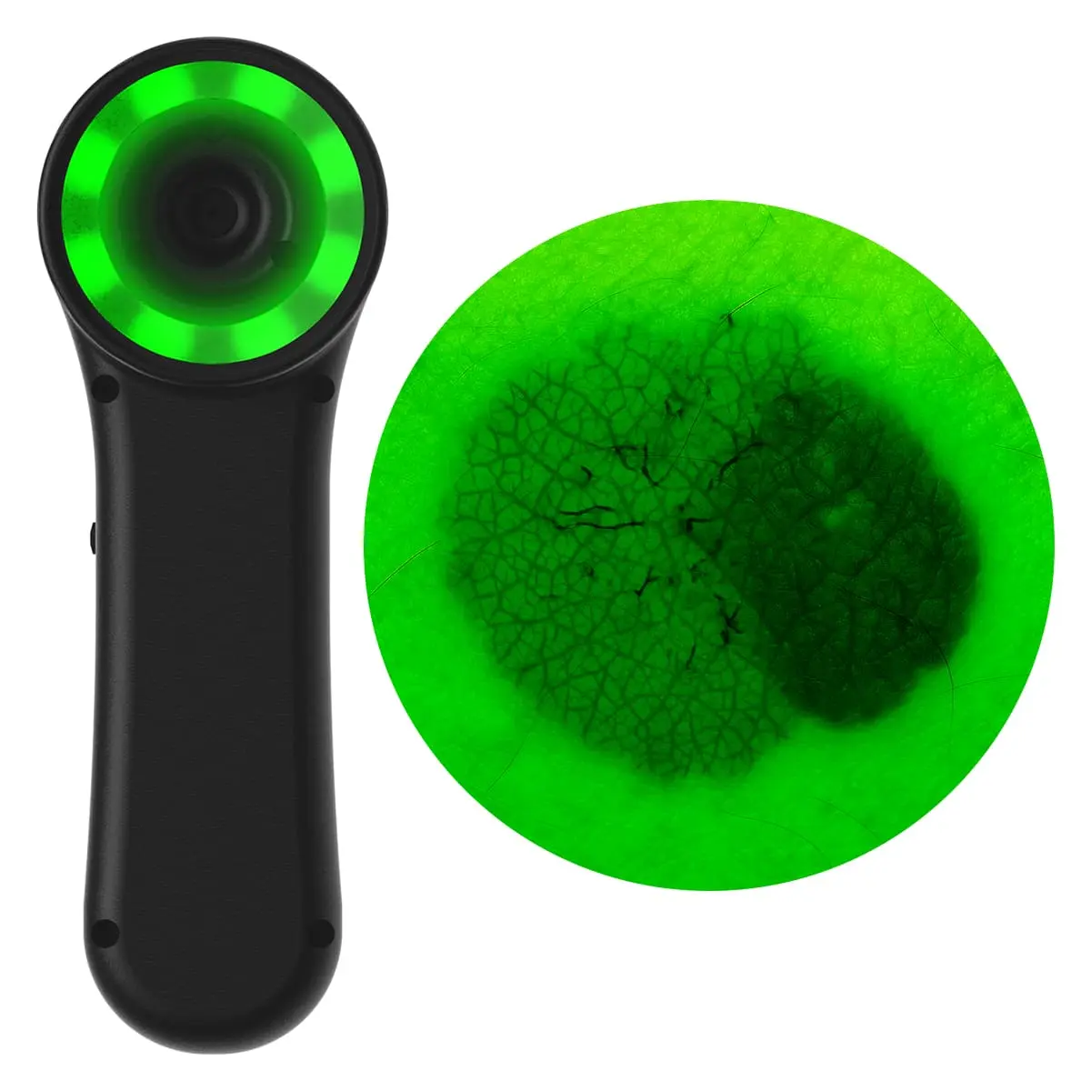  Digitales Dermatoskop "Scaut®"