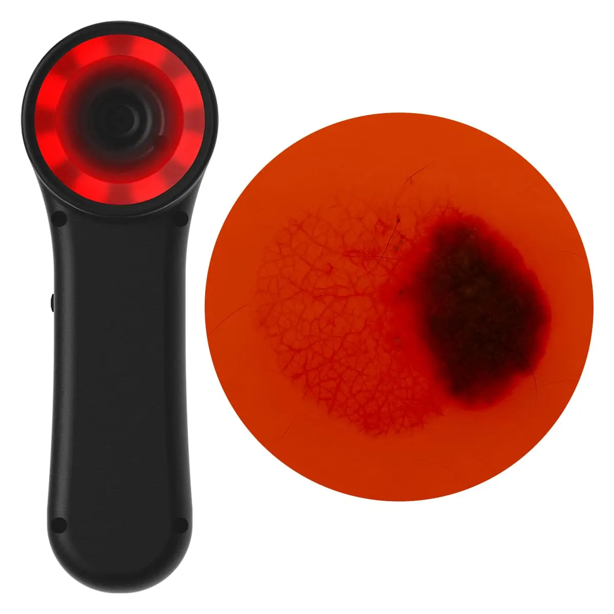  Digitales Dermatoskop "Scaut®"