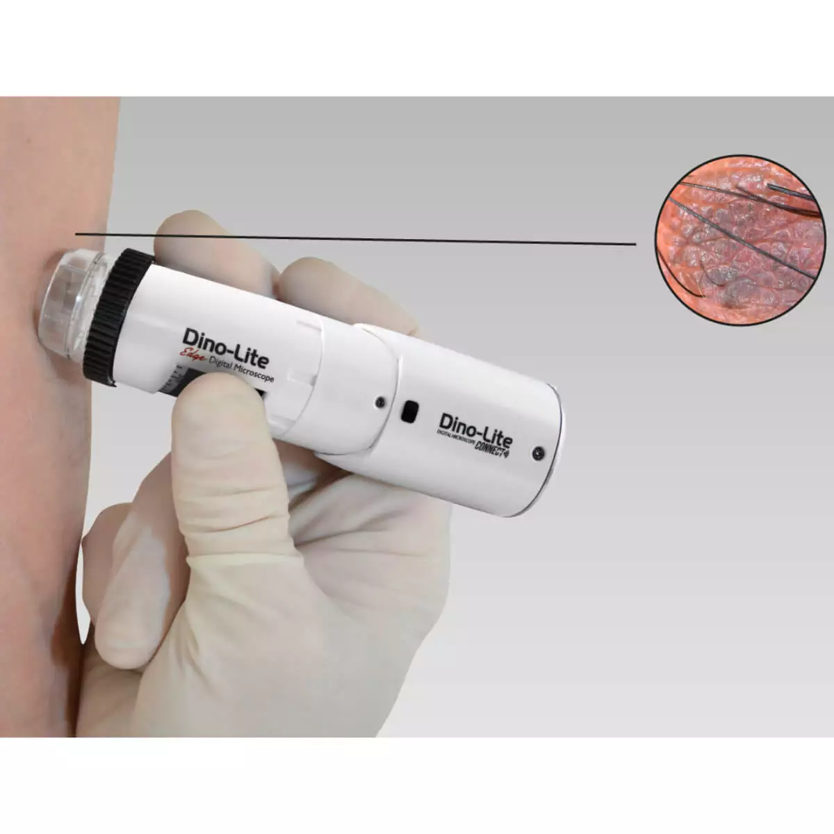  DermaScope Polarizer Wireless Videodermatoskop