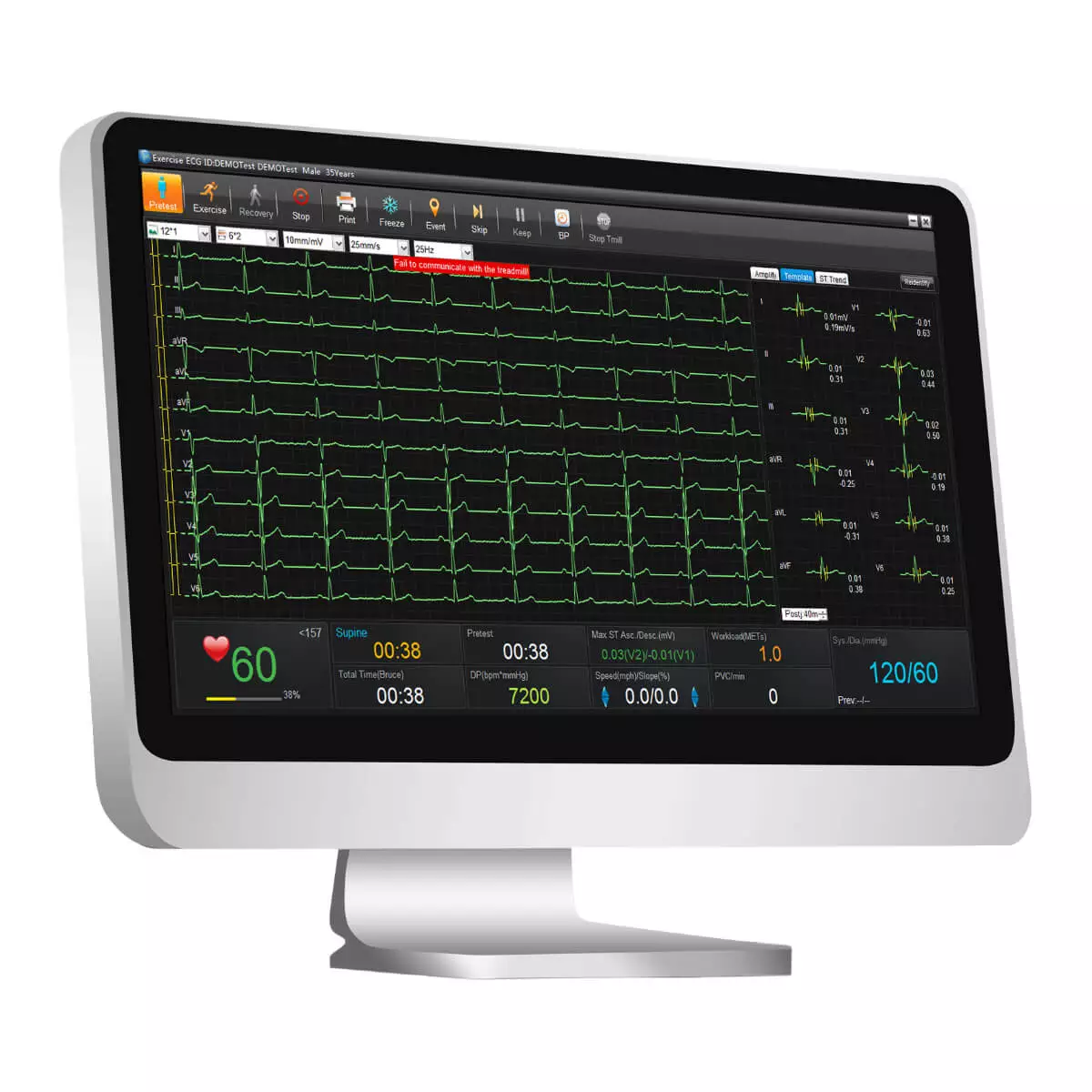  SE-1515 EKG Datenmanagement-Software