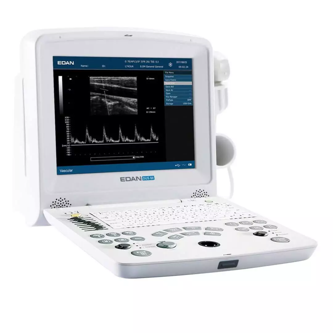  DUS 60 Ultraschallgerät