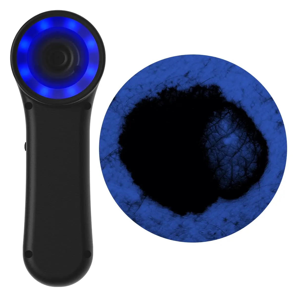  Digitales Dermatoskop "Scaut®"