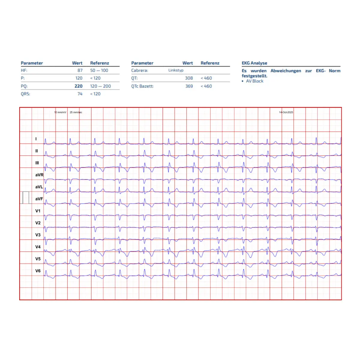 Cardisio KI-gestütztes 3D-EKG  Cardisio KI-gestütztes 3D-EKG