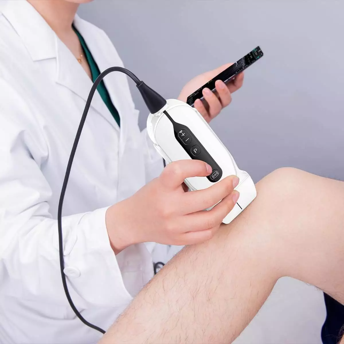 SonoEye G2 Handheld Ultraschallgerät SonoEye G2 Handheld Ultraschallgerät