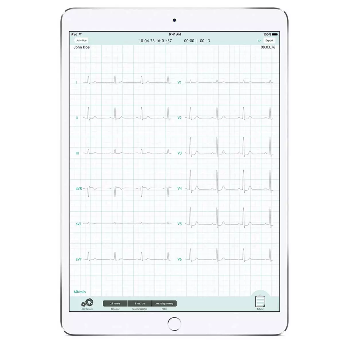  CardioSecur Pro EKG