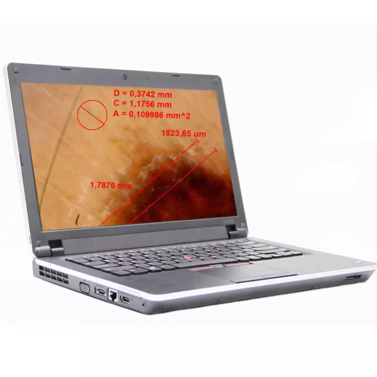  DermaScope Polarizer Wireless Videodermatoskop