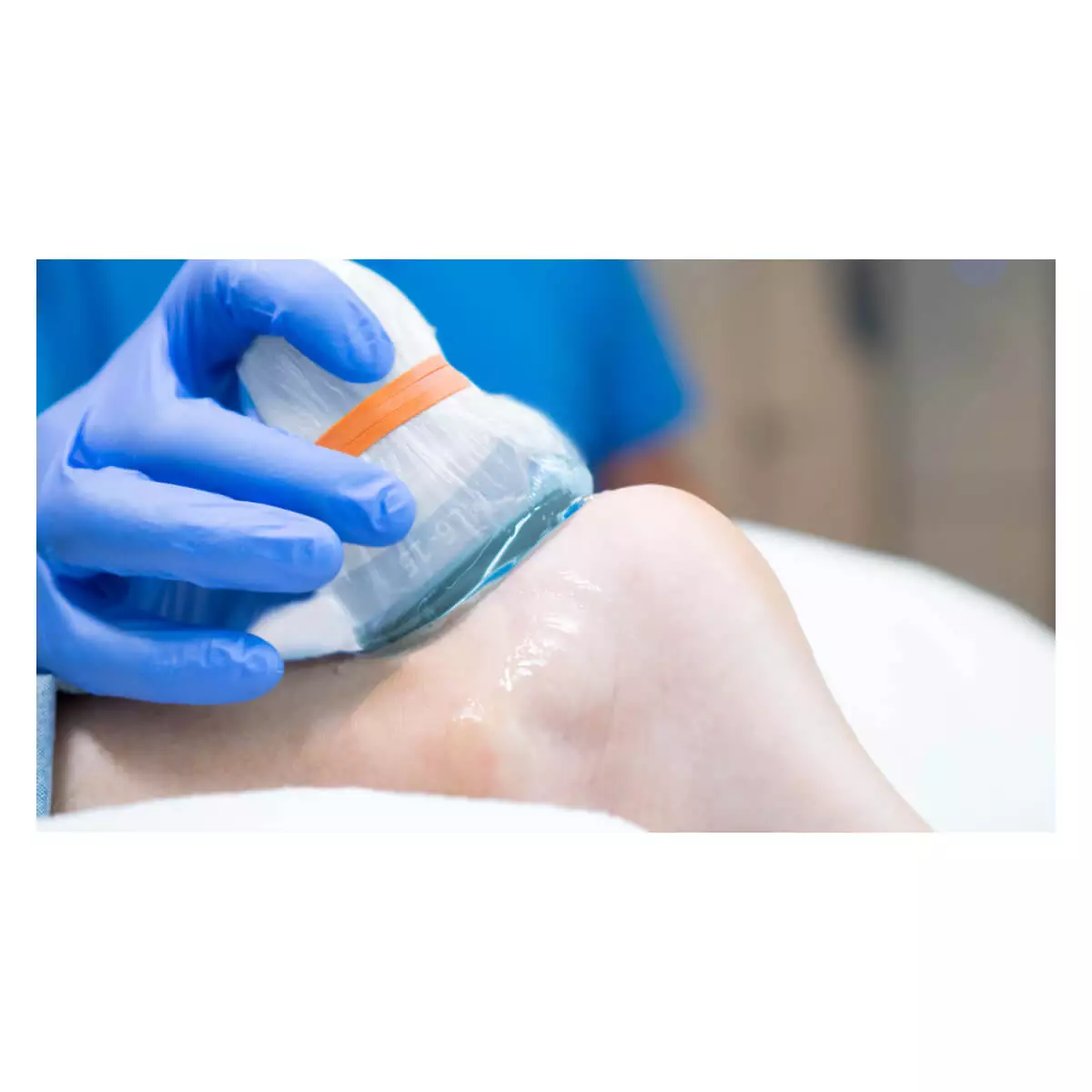  aiSon FOCUS Gelpads für Ultraschallsonden