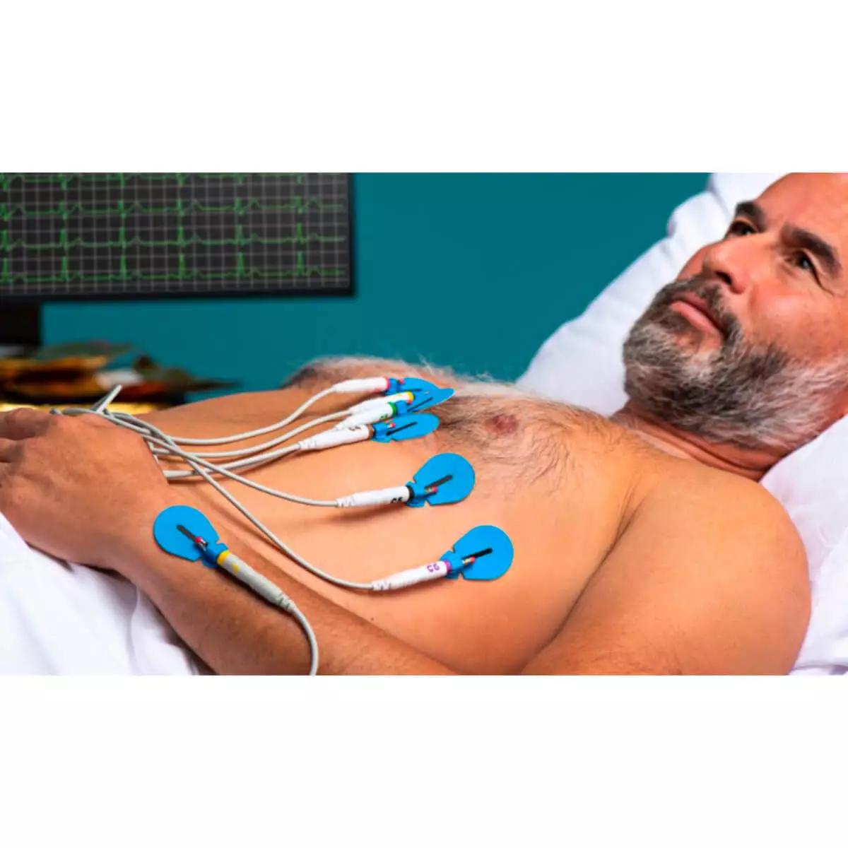  BlueSensor SU-00-A/60 Einweg-EKG-Elektroden