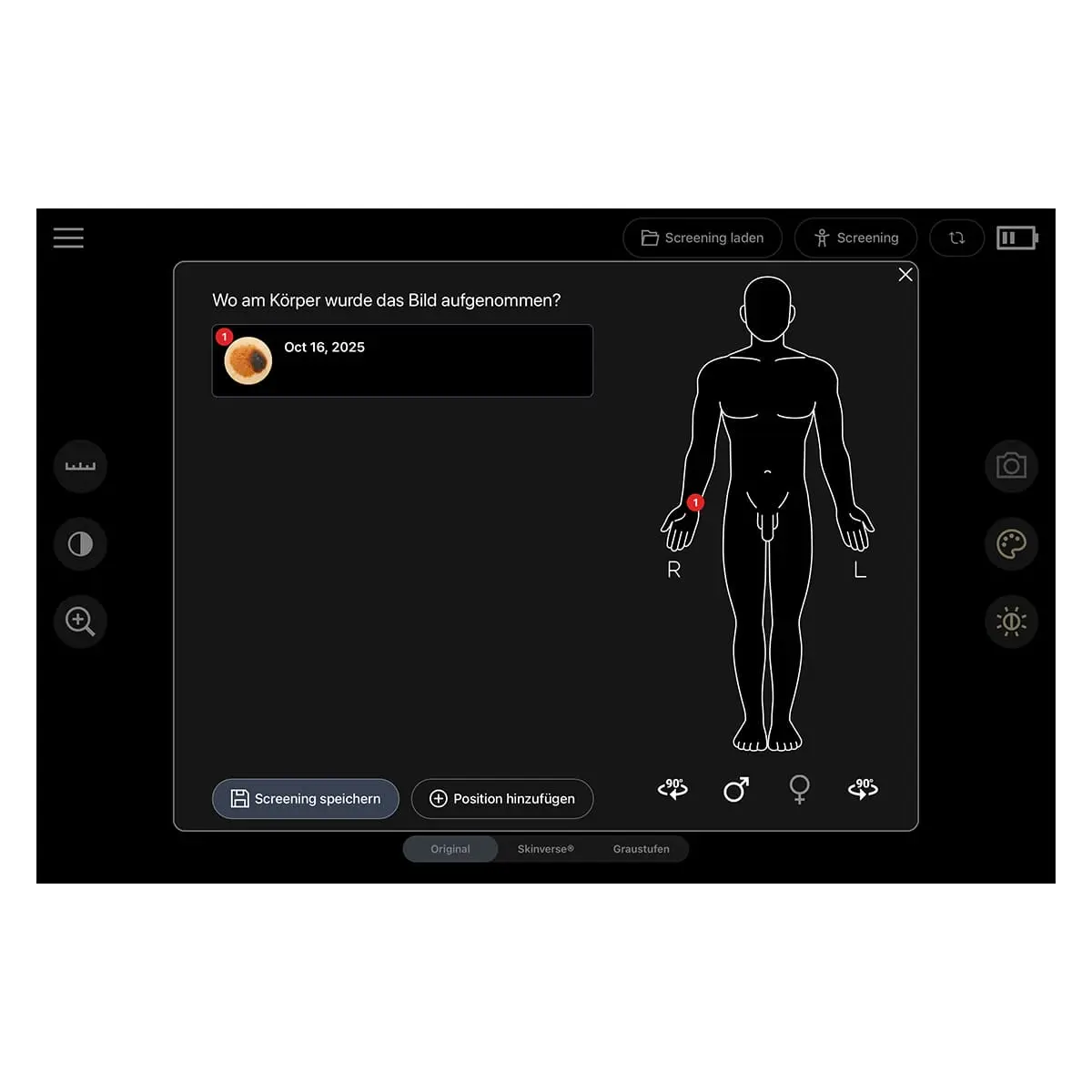  Digitales Dermatoskop "Scaut®"