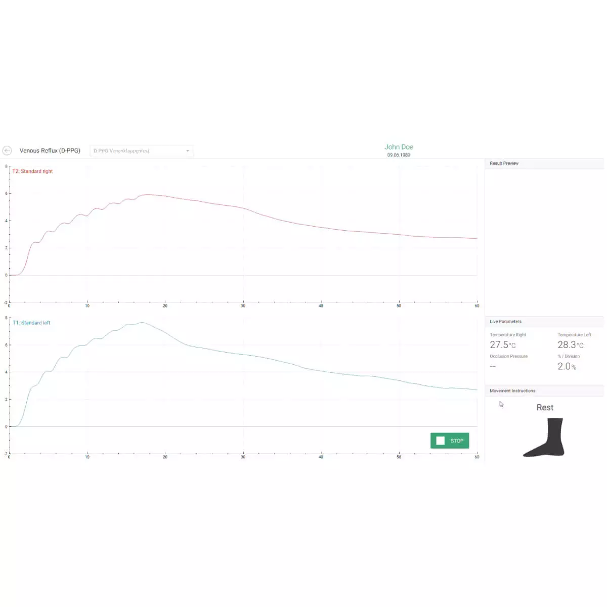  AngE Phlebo PPG Diagnostiksystem
