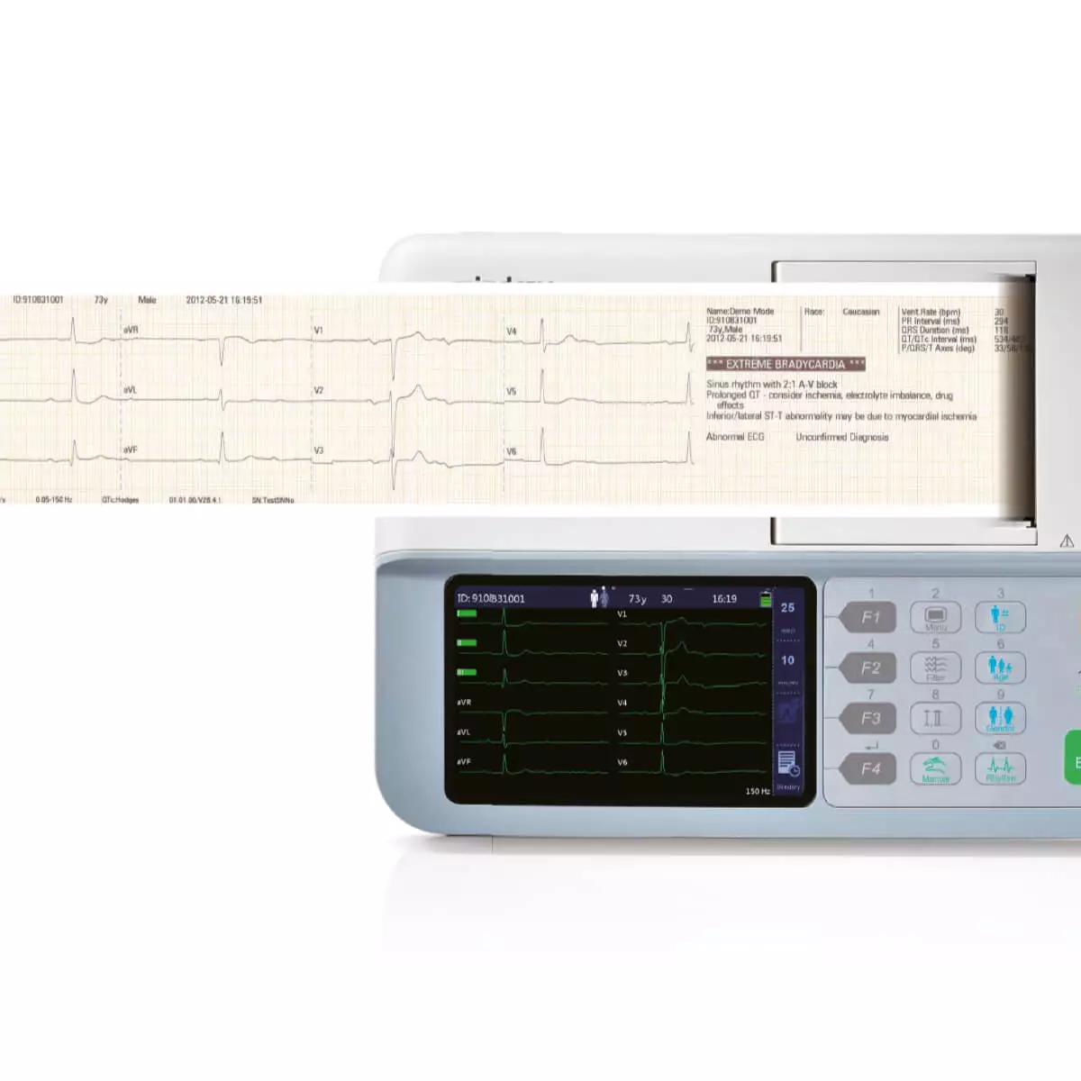  BeneHeart R3 EKG