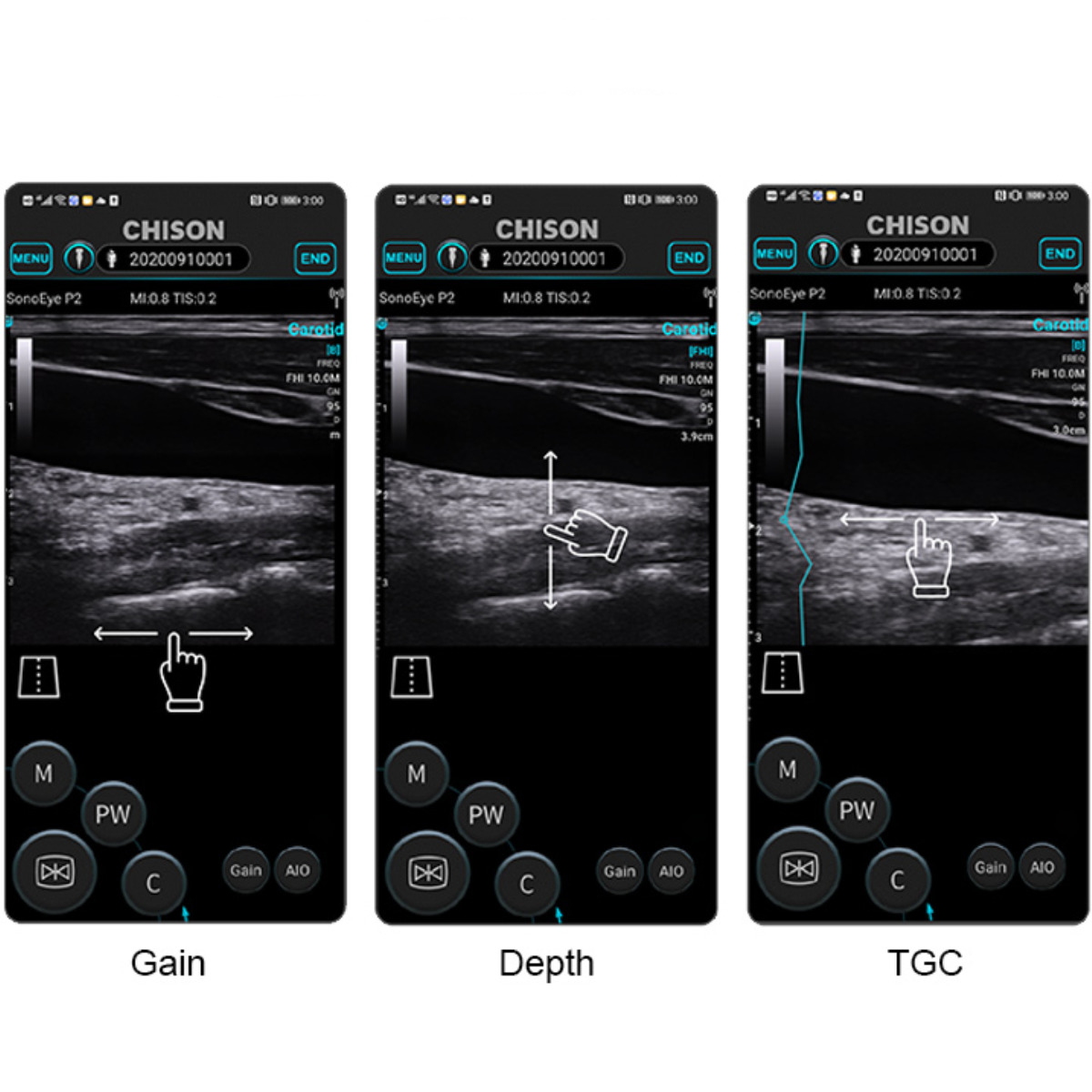  SonoEye mobiles Ultraschallsystem