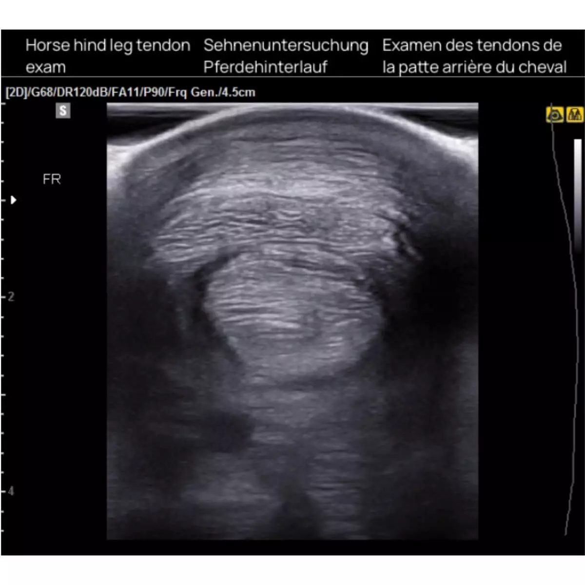  aiSon FOCUS Gelpads für Ultraschallsonden