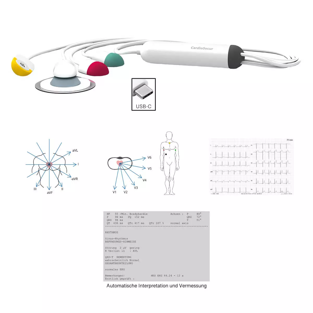 CardioSecur Pro EKG CardioSecur Pro EKG