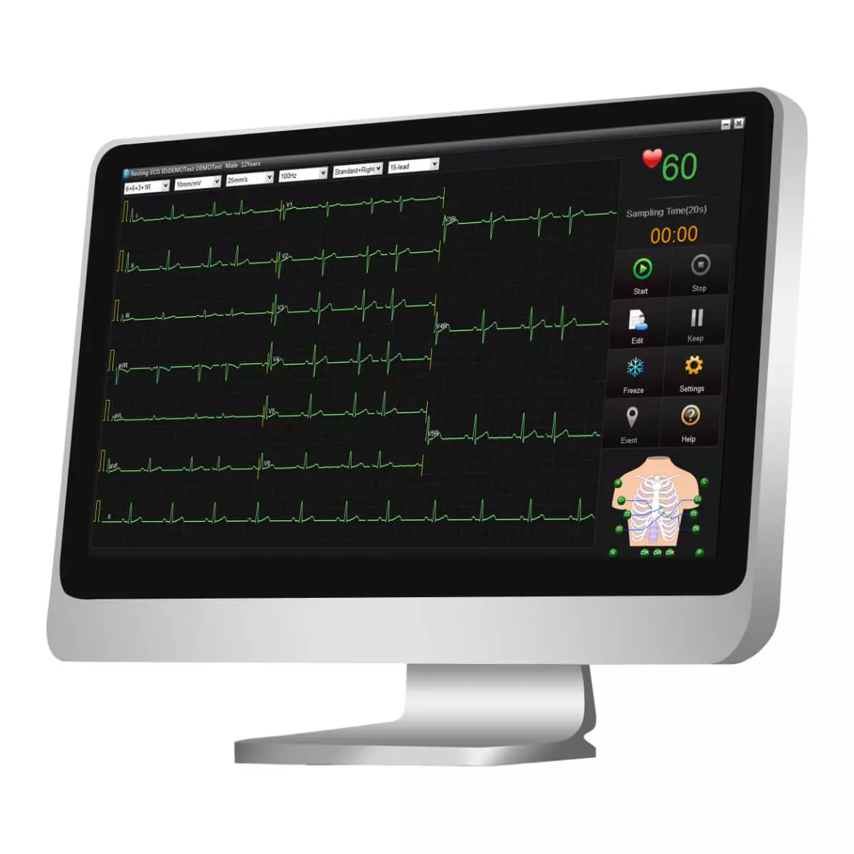  SE-1515 EKG Datenmanagement-Software