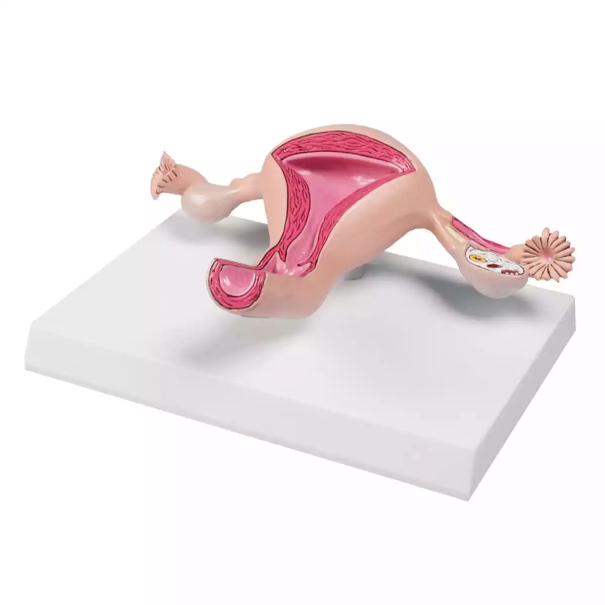  Uterusmodell