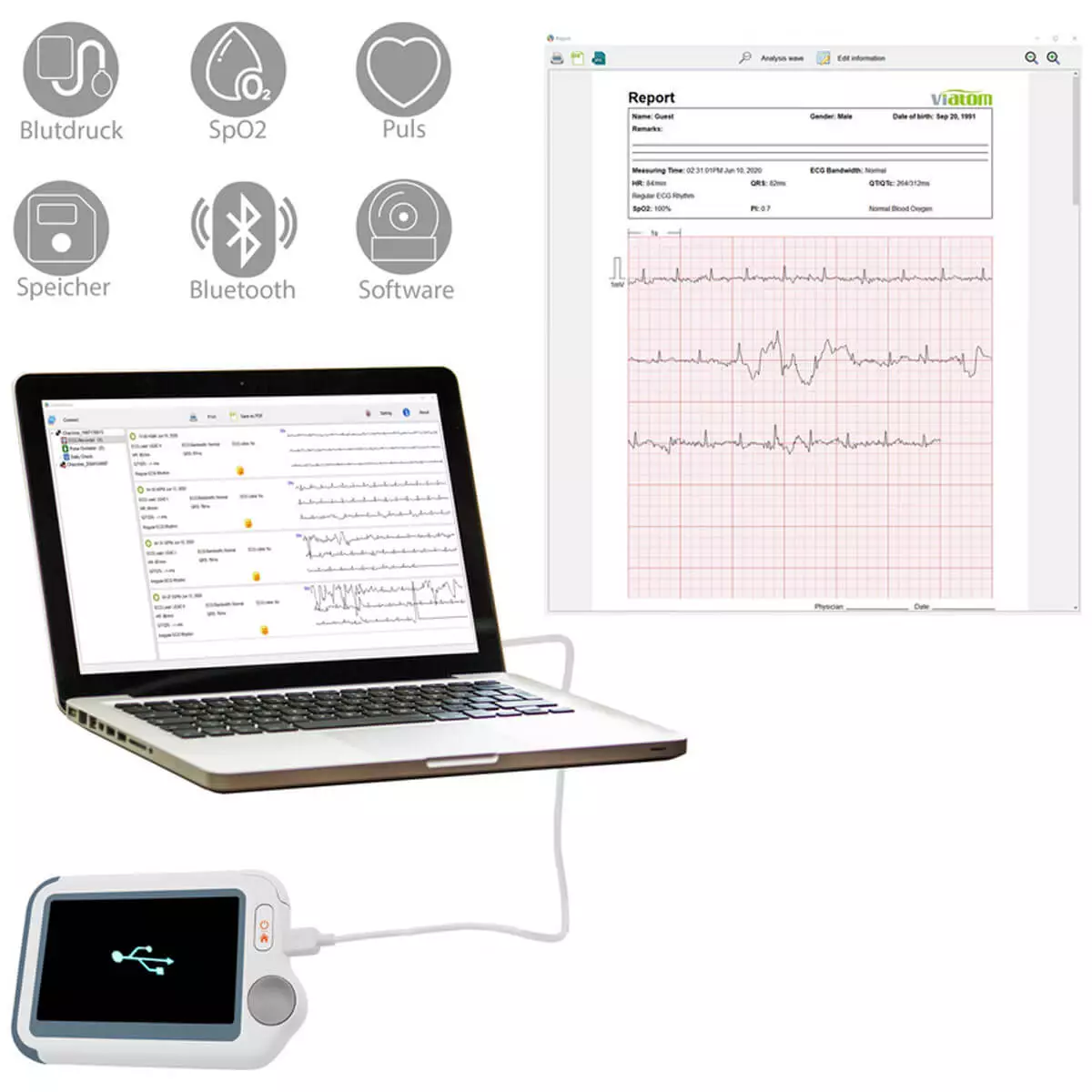  Checkme Lite by Viatom EKG-Monitor