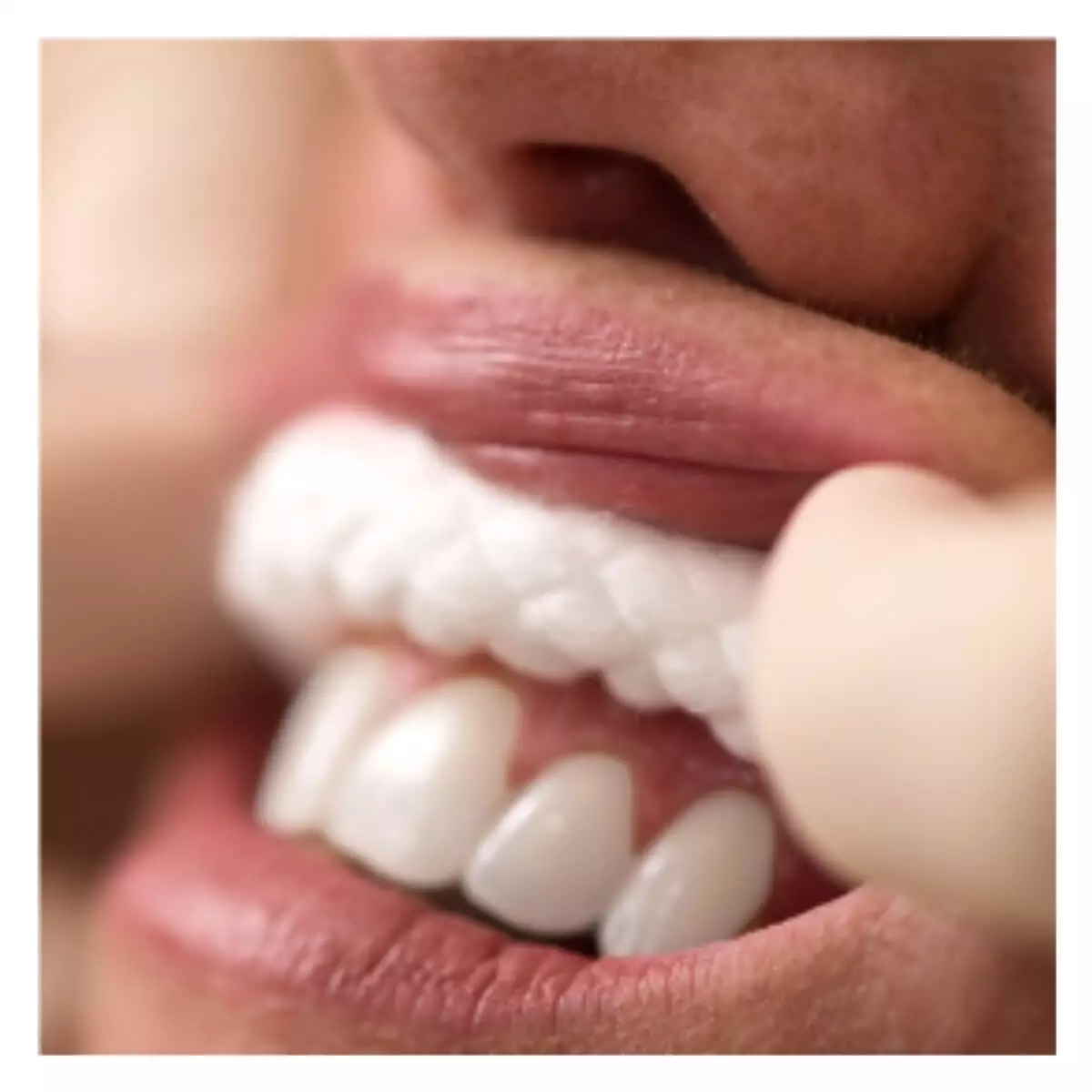 Braided Cotton Rolls Braided Cotton Rolls