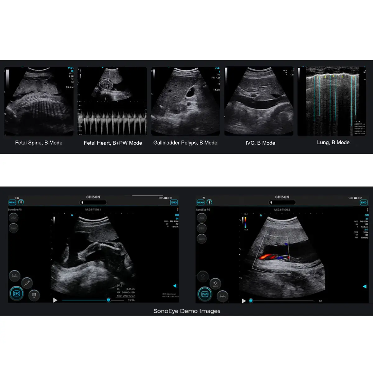 SonoEye mobiles Ultraschallsystem