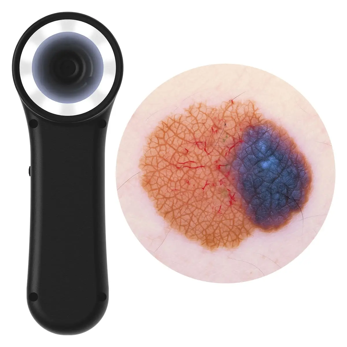  Digitales Dermatoskop "Scaut®"