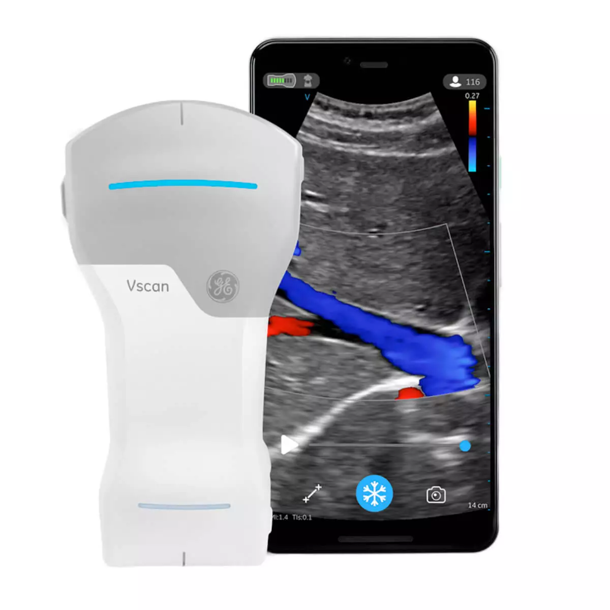 Vscan Air CL Ultraschallsystem Vscan Air CL Ultraschallsystem